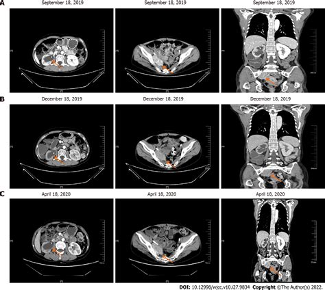 Diagnostic features and therapeutic strategies for malignant