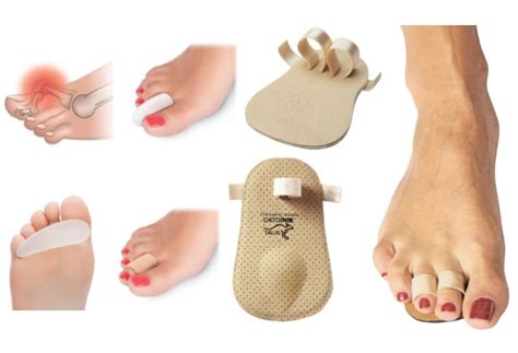 Молоткообразня деформация пальцев стопы