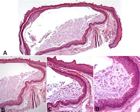 Histopathological Exam Image Download Scientific Diagram