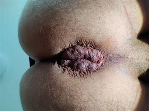 My Anus Nude Pics XHamster