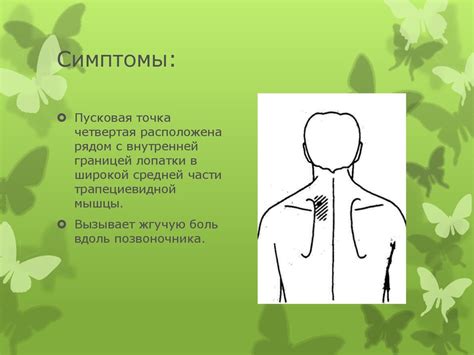 Триггерные точки - презентация онлайн