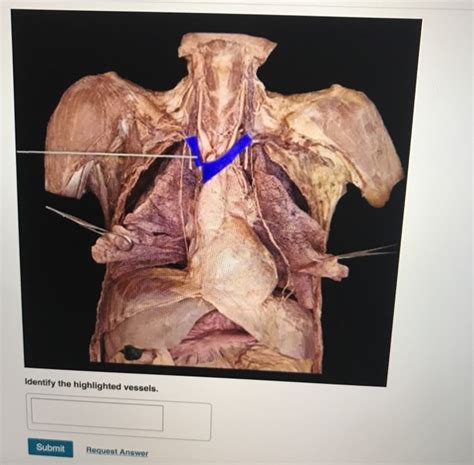 Solved Identify The Highlighted Structure Submit Request Chegg