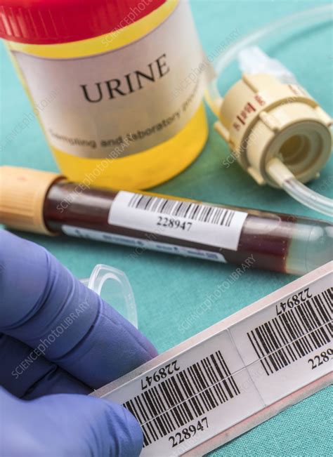 Doctor labelling blood sample at a hospital table - Stock Image - F035 ...