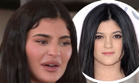Kylie Jenners Changing Face As The Kardashians Star Denies Surgery