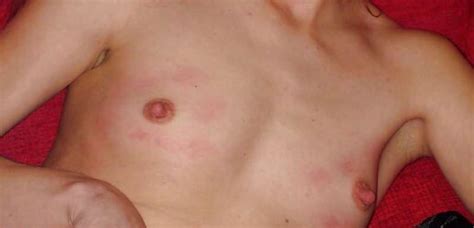 Forceps On My Melons Fervor Gal German Fledgling ZB Porn