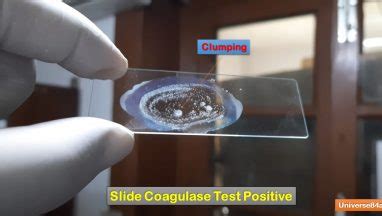 Slide Coagulase Test Introduction Principle Procedure Result