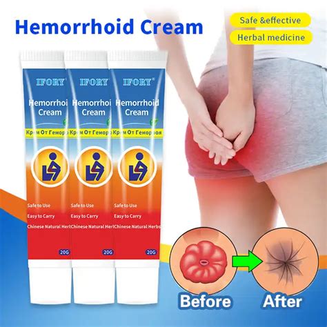 OEM Anal Fissure Hemorrhoid Cream Chinese Herbal Cream Ointment Hemorrhoids Alibaba
