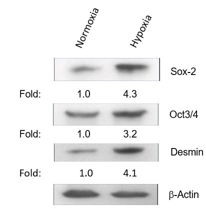 Hypoxia induces lineage modulation of Ewing?s sarcoma tumor cells into ...