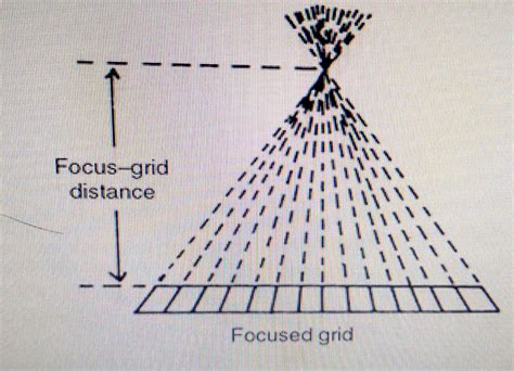Grids Radiologystar