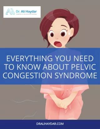 PPT Causes And Treatment Of Pelvic Congestion Syndrome PowerPoint