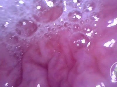 Inside Pov Inflating My Bladder With Air Preview Free Mobile Porn Videos IPornTV