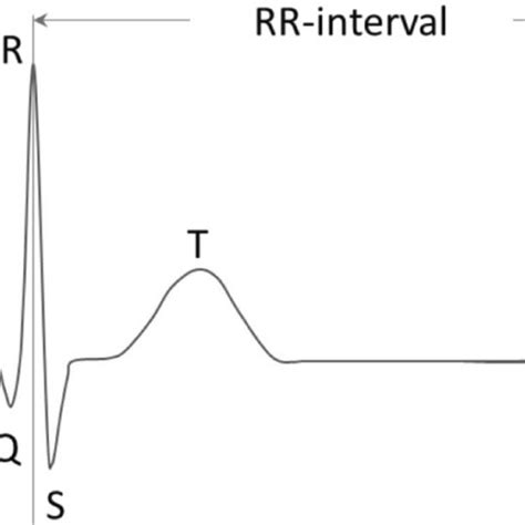 typical ecg waveform   including waves  scientific