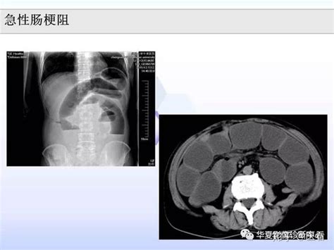 服！放射科主任总结的5大类医学影像危急值（建议收藏） 知乎