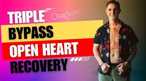 Triple Bypass Open Heart Surgery Recovery Youtube