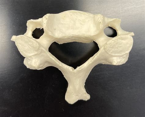 Cervical Vertebrae Superior View Diagram Quizlet