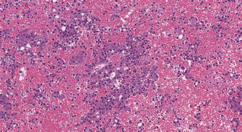 Salivary Gland Cytology Ottawa Atlas Of Pathology