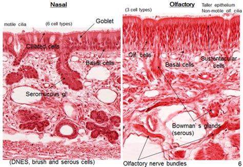 Exam 4 Respiratory Pathology Flashcards Quizlet