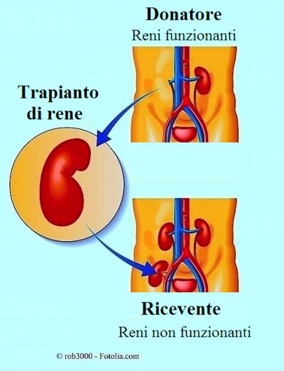 Trapianto Di Rene Da Vivente Durata E Complicanze