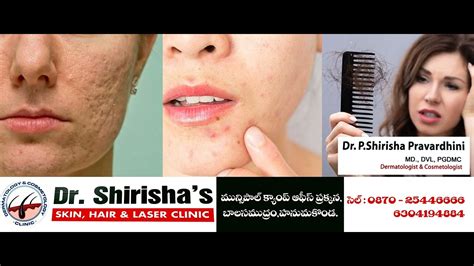 Dr Shirisha Skin Hair Laser Clinic Anand Ads YouTube