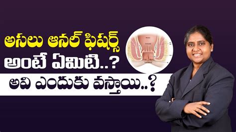 అసల ఆనల ఫషరస అట ఏమట What is an anal fissure Vardhan Ayurveda YouTube