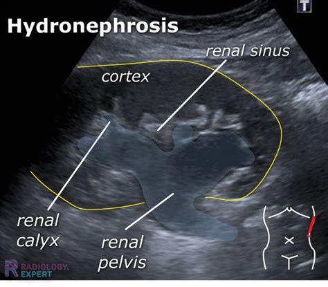 Abdominal ultrasound