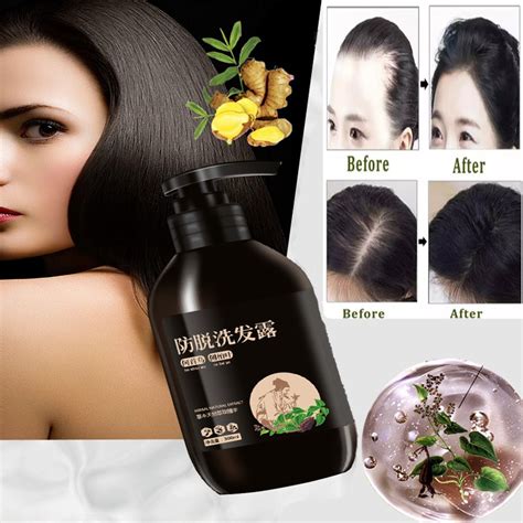 300ml Ginger Anti Hair Loss Shampoo Prevent Hair Fall Promote Hair