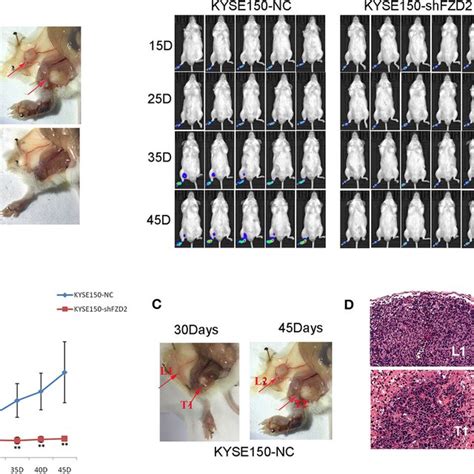 FZD2 Promoted The Metastasis Of ESCC Cells In A Mouse Model A