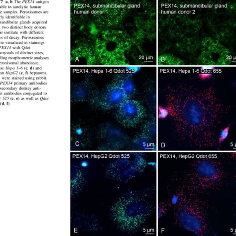 (PDF) The biogenesis protein PEX14 is an optimal marker for the ... 