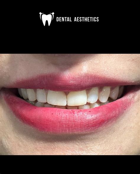 dental aesthetics lahore