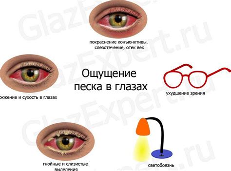 Причины ощущения песка в глазах, диагностика, лечение, отзыв