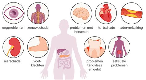 Cijfers Over Diabetes Diabetes Nl