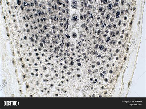 Root Tip Onion Mitosis Image Photo Free Trial Bigstock