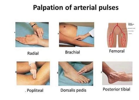 Palpation Of Arterial Pulse MEDizzy