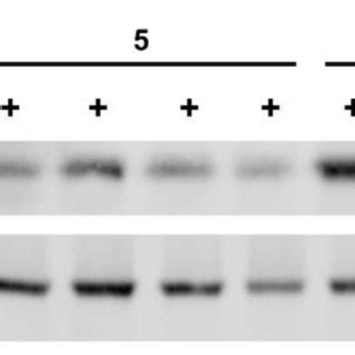 Groundsel bush attenuates TNF α induced repression of adiponectin