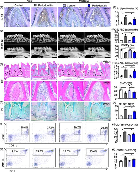 NLRP3 Regulates Alveolar Bone Loss In Ligatureinduced Periodontitis By