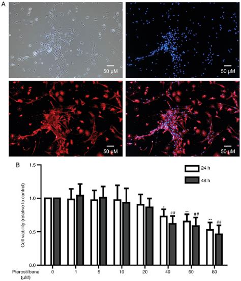 Figure 1 From Pterostilbene Inhibits Reactive Oxygen Species Production