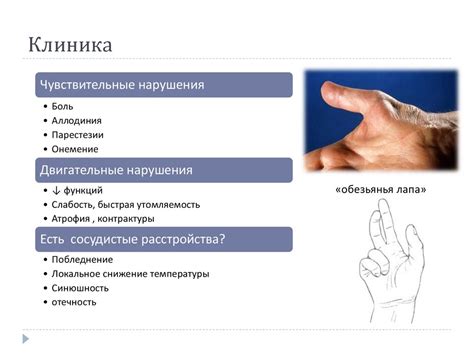 Синдром карпального канала - презентация онлайн