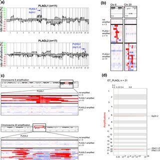 Imaging And Histologic Features Of Cns Embryonal Tumors With Plagl Gene