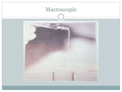 Diagnostic approach to knee joint effusion | PPTX