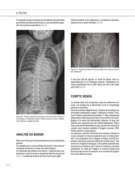 Savoir faire en radiologie ostéo articulaire n25 Jean Denis Laredo