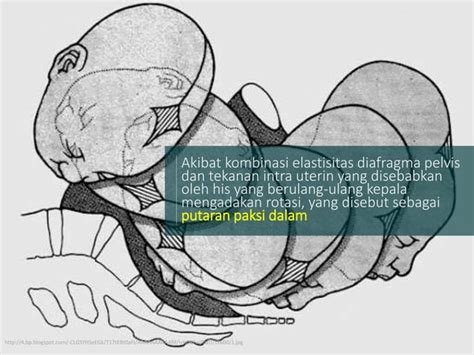 Modul 1 Kb 2 Tahapan Persalinan