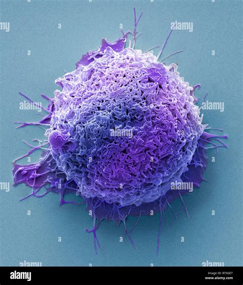 Colorectal Cancer Cell Coloured Scanning Electron Micrograph Sem Of