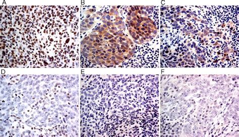 Immunohistochemical Staining For Phosphorylated P Egfr And