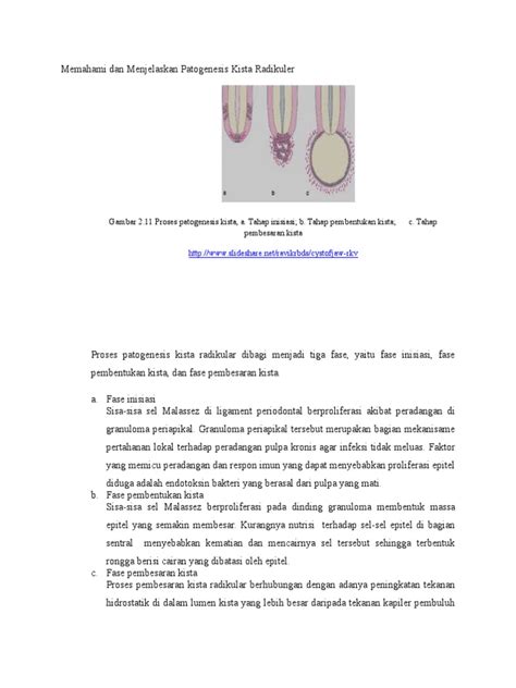 Patogenesis Kista Radikuler Pdf