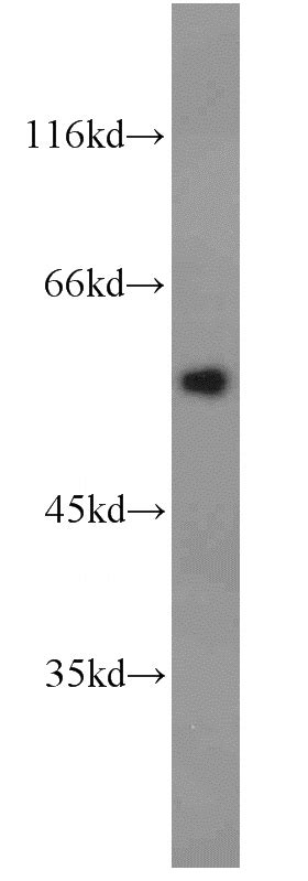 Antithrombin Iii Rabbit Polyclonal Antibody