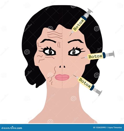 Botox Lips Cartoon At Edward Acosta Blog
