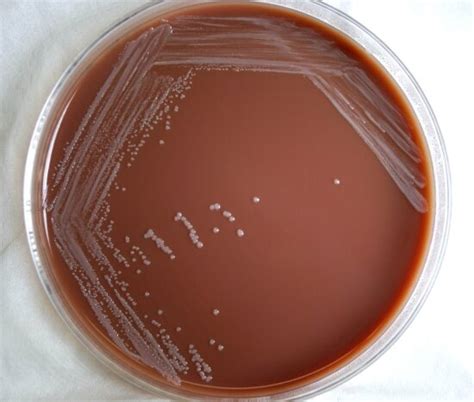 Free Picture Photograph Colonial Morphology Gram Negative