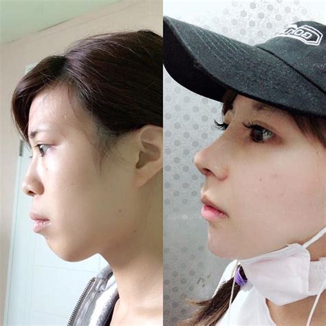 Hot girl mạng xinh như nữ thần thế nhưng nhan sắc quá khứ lại khiến các fan khóc thét vì sợ hãi