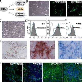 Improper Maturation Of The HiPSC Derived NCCs After Intracameral