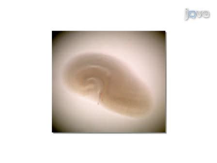 Organotypic Hippocampal Slice Cultures 